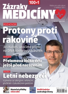 Zázraky medicíny 7-8/2018 - Protony proti rakovině